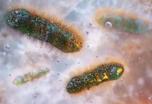 Dizanteri, genellikle bağırsaklarda iltihaplanma ile sonuçlanan, ciddi bir gastrointestinal enfeksiyon hastalığıdır. Temelde iki farklı bakteri türü, Shigella ve Entamoeba histolytica, bu hastalığın başlıca nedenlerindendir. Dizanteri, fekal-oral yoluyla bulaşır ve temiz suya erişimin kısıtlı olduğu yerlerde yayılma riski çok daha fazladır. Kirli su, hastalığın hızla yayılmasına zemin hazırlar. Bu nedenle, dizanteri ile mücadele etmenin en önemli yollarından biri, sağlıklı içme suyu teminidir. Su kaynaklarının temizliği, bu hastalığın yayılmasını önlemede belirleyici bir faktördür. Konulu bir görsel.