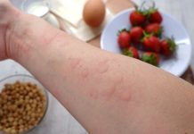 Günümüzde birçok kişi, gıda intoleransı ya da gıda alerjisi gibi sağlık sorunlarıyla karşı karşıya kalabiliyor. Hem gıda intoleransı hem de gıda alerjisi, tüketilen gıdalara karşı vücudun olumsuz reaksiyonlar vermesiyle kendini gösterir. Ancak, bu iki durum arasında önemli farklar bulunmaktadır. Gıda intoleransı ve alerjisi, belirtilerinin benzer olması nedeniyle sıklıkla karıştırılsa da, vücudun her iki duruma verdiği tepki farklı mekanizmalarla işler. Bu yazıda, gıda intoleransı ve gıda alerjisi arasındaki temel farkları detaylı bir şekilde ele alacağız. Konulu bir haber görseli.