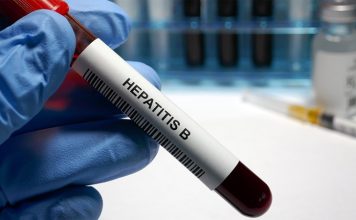 Hepatit B ve C Nedir Karaciğere Ne Gibi Zarar Verir Hepatit B ve C, karaciğeri etkileyen viral enfeksiyonlar olup, bu hastalıklar uzun dönemde ciddi sağlık sorunlarına yol açabilir. Her iki hastalık da karaciğerde iltihaba neden olur, ancak Hepatit B ve Hepatit C arasında bazı önemli farklar bulunmaktadır. Hepatit B, genellikle daha kısa vadede fark edilen ve aşıyla korunulabilen bir hastalıkken, Hepatit C genellikle yıllarca belirti vermez ve tedavi edilmezse karaciğerde kalıcı hasara yol açabilir. Her iki enfeksiyon türü de karaciğerde ciddi hasarlara, siroz ve karaciğer kanseri gibi tehlikeli hastalıklara yol açabilir. Bu yazıda, Hepatit B ve C’nin ne olduğunu, nasıl bulaştıklarını, karaciğere verdikleri zararları ve tedavi yöntemlerini inceleyeceğiz. Konulu bir haber görseli.
