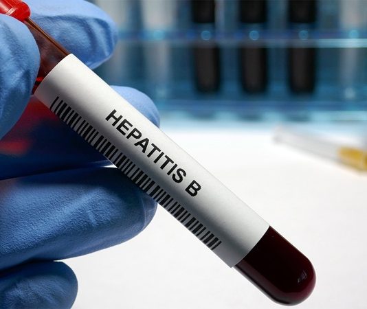 Hepatit B ve C, karaciğeri etkileyen viral enfeksiyonlar olup, bu hastalıklar uzun dönemde ciddi sağlık sorunlarına yol açabilir. Her iki hastalık da karaciğerde iltihaba neden olur, ancak Hepatit B ve Hepatit C arasında bazı önemli farklar bulunmaktadır. Hepatit B, genellikle daha kısa vadede fark edilen ve aşıyla korunulabilen bir hastalıkken, Hepatit C genellikle yıllarca belirti vermez ve tedavi edilmezse karaciğerde kalıcı hasara yol açabilir. Her iki enfeksiyon türü de karaciğerde ciddi hasarlara, siroz ve karaciğer kanseri gibi tehlikeli hastalıklara yol açabilir. Bu yazıda, Hepatit B ve C’nin ne olduğunu, nasıl bulaştıklarını, karaciğere verdikleri zararları ve tedavi yöntemlerini inceleyeceğiz. Konulu bir haber görseli.