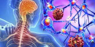 Multipl Skleroz (MS), merkezi sinir sistemini etkileyen ve bağışıklık sisteminin sinir hücrelerine zarar vermesiyle karakterize edilen kronik bir hastalıktır. Beyin ve omurilikteki sinir liflerinin etrafını saran miyelin kılıfının tahrip olmasıyla oluşan bu durum, bilgi akışının kesintiye uğramasına ve ciddi nörolojik sorunlara yol açar. Hastalık, genellikle genç erişkinlerde başlar ve yaşam boyu sürebilir. Erken tanı ve uygun tedaviyle hastalığın etkileri azaltılabilmektedir. Konulu bir haber görseli.