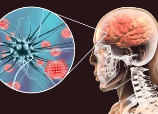 Menenjit, beyin ve omuriliği çevreleyen zarların iltihaplanmasıyla oluşan bir hastalıktır. Bu durum, genellikle bakteriyel, virüs veya fungal enfeksiyonlar sonucunda meydana gelir ve hayati tehlike oluşturabilecek bir sağlık sorunu olarak kabul edilir. Menenjit belirtileri hızla ortaya çıkabileceği için erken tanı ve tedavi büyük önem taşır. Bu yazıda, menenjitin ne olduğunu, belirtilerini, nasıl teşhis edilebileceğini ve erken tanının neden bu kadar kritik olduğunu ele alacağız. Konulu bir haber görseli.
