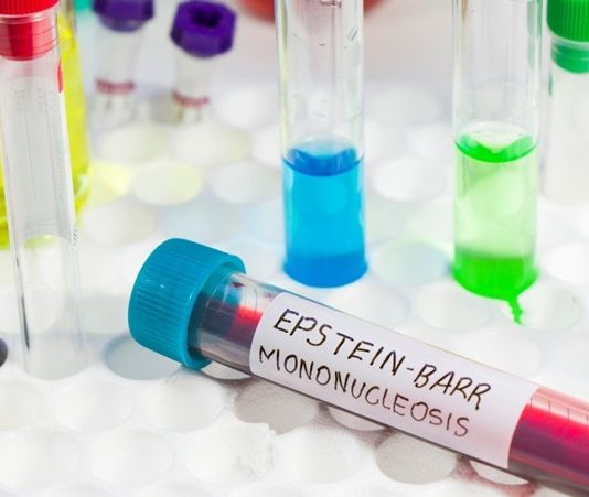 Mononükleoz Hastalığı Gençlerde Neden Yaygın Mononükleoz, halk arasında “öpücük hastalığı” olarak da bilinen ve genellikle Epstein-Barr virüsü (EBV) nedeniyle ortaya çıkan bulaşıcı bir hastalıktır. Bu hastalık çoğunlukla genç bireylerde görülür ve özellikle ergenlik dönemindeki kişiler arasında yaygınlık kazanır. Bu yaygınlığın birçok biyolojik, davranışsal ve çevresel nedeni bulunmaktadır. Bağışıklık sistemi, hijyen koşulları, sosyal alışkanlıklar ve vücut direnci, hastalığın görülme sıklığını etkileyen başlıca faktörler arasındadır. Konulu bir haber görseli.